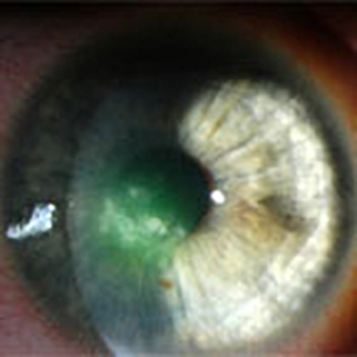 Read more about the article What’s safe—and not so safe—to use in your pregnant patients