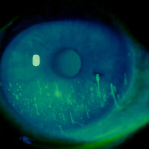 Read more about the article Guide your patients toward better gel and ointment use