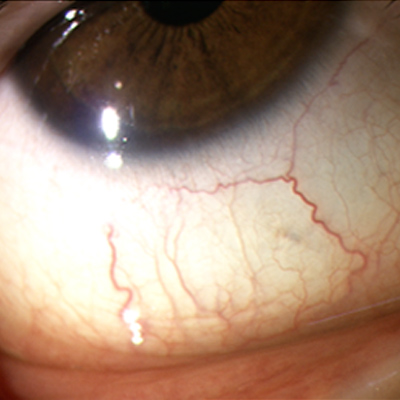 Read more about the article Perspectives on probiotics