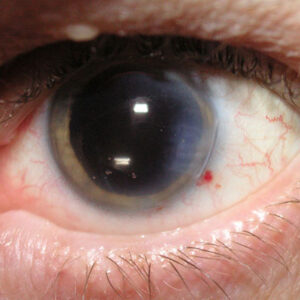 Read more about the article An unusual dilation issue