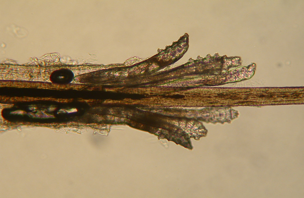 Six adult Demodex folliculorum on an eyelash