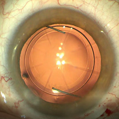 Read more about the article Technologies for achieving better outcomes