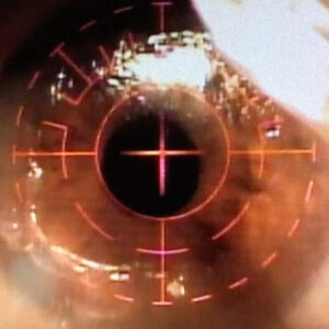 Read more about the article Comparing laser refractive surgery, phakic IOLs, and lens replacement