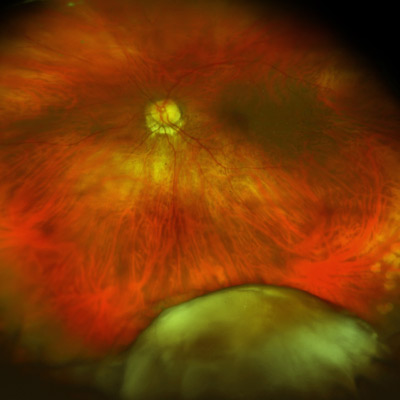 Read more about the article Handling a dropped nucleus