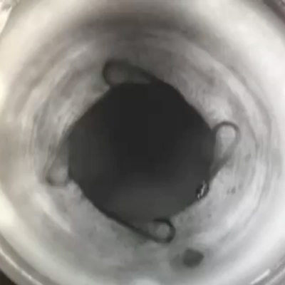 Read more about the article Premium cataract surgery technologies in the context of glaucoma