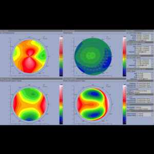 Read more about the article Experts differ on corneal astigmatism correction in cataract surgery
