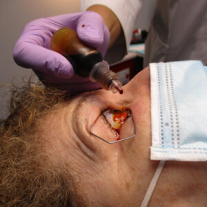 Read more about the article Povidone-iodine drops as a COVID-19 preventative measure