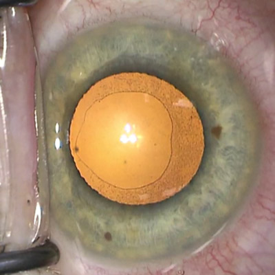 Read more about the article The latest in DSO