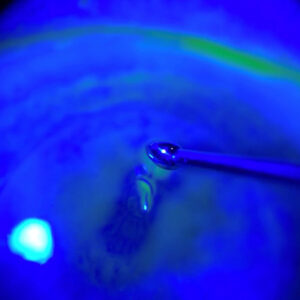 Read more about the article Corneal sweep test for recurrent corneal erosion