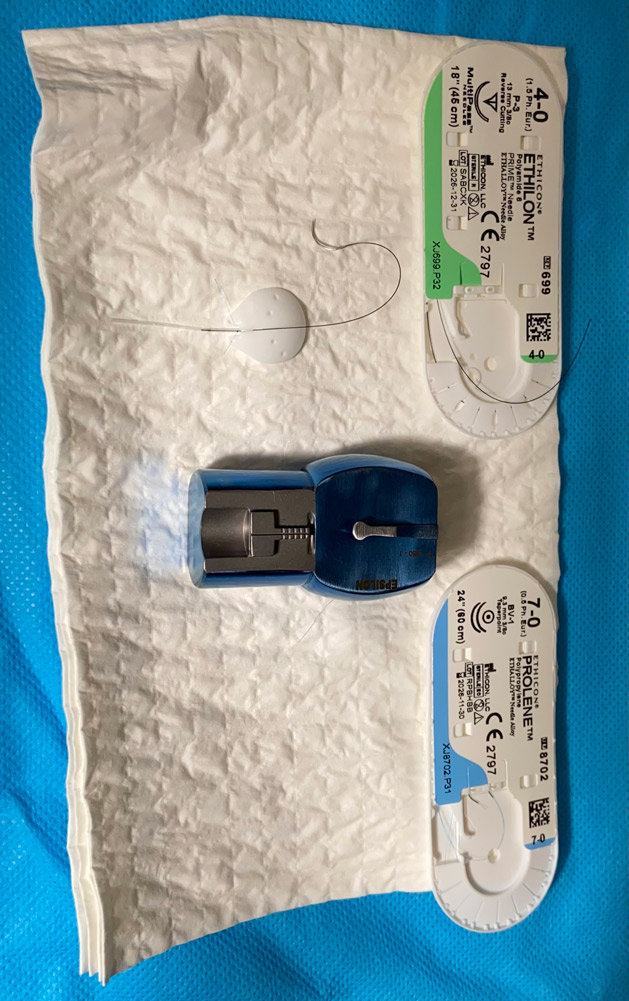 This is the 250 ClearPath after being tied off on the back table with a 7-0 Prolene suture (keeping the wings long so they lay flat along the sclera) with a 4-0 nylon rip cord that will be tucked in the subconjunctival space in the inferior temporal quadrant. The rip cord can be pulled 1โ6 months later at the slit lamp in the clinic in order to open the tube.