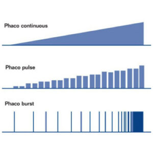 Read more about the article Phaco fundamentals: Device settings and best practices for routine to complex phacoemulsification