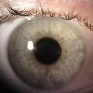 Read more about the article A discussion on SMILE