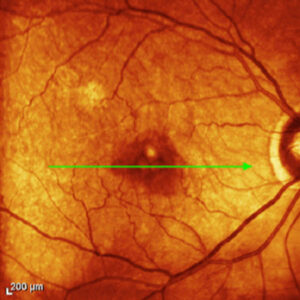 Read more about the article What’s up with NSAIDs?