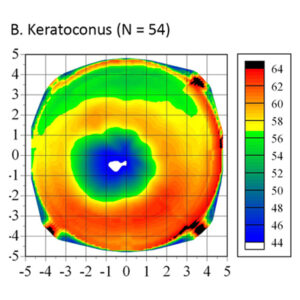 Read more about the article Word on the street about epithelial mapping