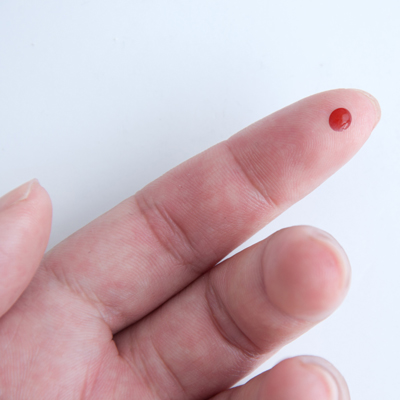 Read more about the article Research on finger-prick autologous blood for ocular conditions continues