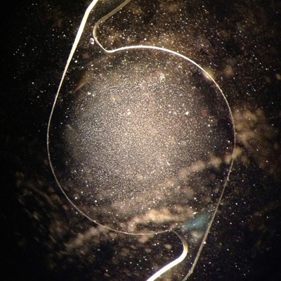 Read more about the article Potential issues after cataract surgery