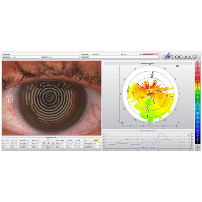Read more about the article Equipment updates advancing refractive surgery
