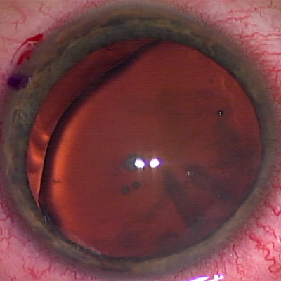 Read more about the article Using CTRs in practice