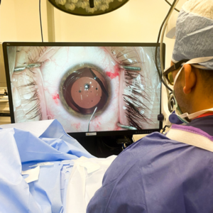 Read more about the article Expanding experience with the EVO ICL