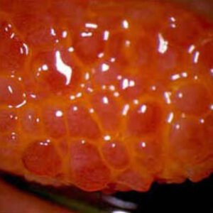 Read more about the article Perspectives on ocular allergy and allergic conjunctivitis