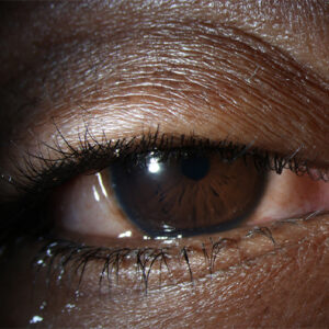 Read more about the article Handling persistent foreign body sensation