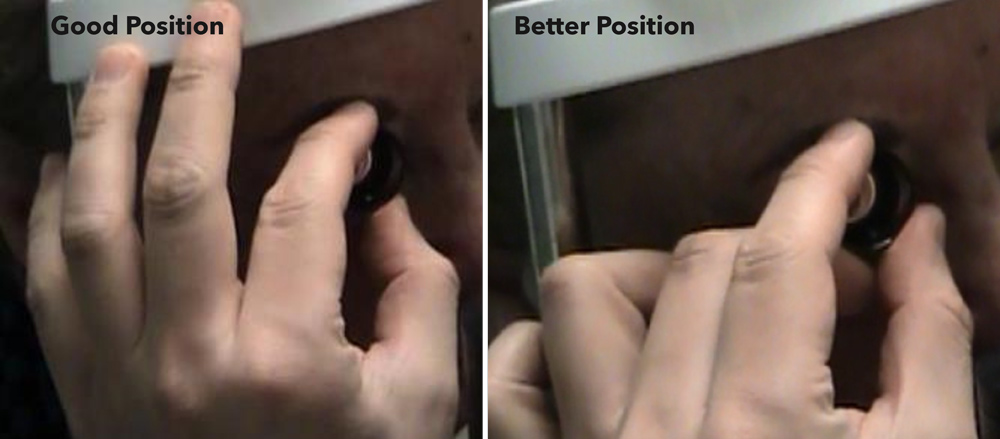 As his laser tip in the session, Dr. Teng suggested placing the third finger below the Abraham lens to facilitate stabilization and rotation.
Source: Christopher Teng, MD