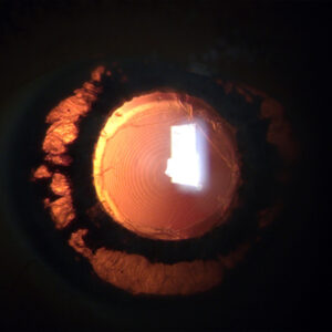 Read more about the article Tips for IOL exchange