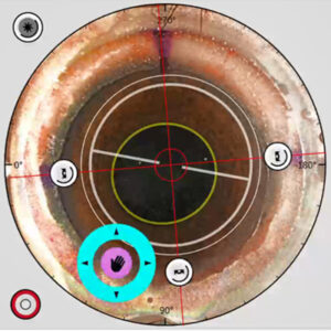 Read more about the article Corneal refractive surgery: the future wish list