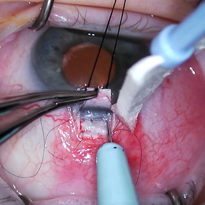 Read more about the article Changes you wish to see in ophthalmology training requirements: new MIGS guidelines