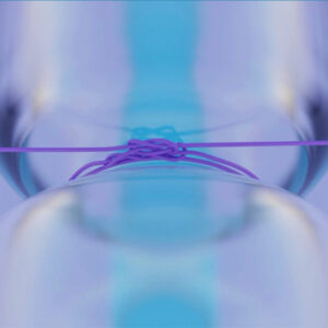 Read more about the article ‘Glaucoma Pearls—High Speed, High Impact’