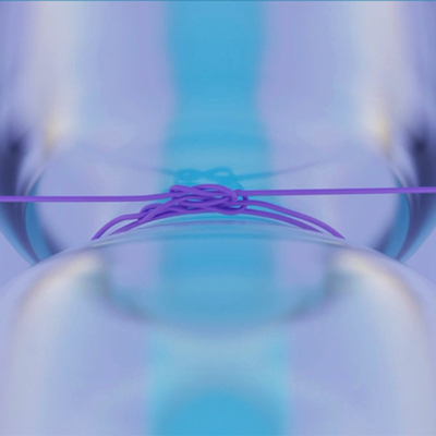 Read more about the article ‘Glaucoma Pearls—High Speed, High Impact’