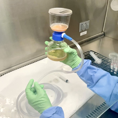 Read more about the article What ophthalmologists wish you knew about platelet-derived therapies