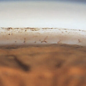 Read more about the article New laser technology in glaucoma