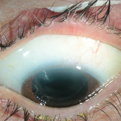 Read more about the article Knocking down XEN obstacles