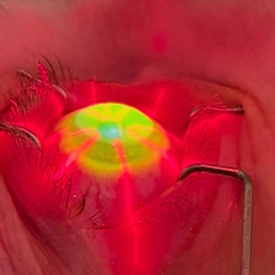 Read more about the article Crosslinking: then, now, and next up