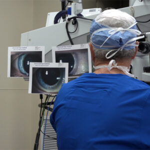 Read more about the article Why it’s still important to discuss toric IOL marking methods