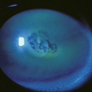 Read more about the article The robust NK and PCED pharmaceutical pipeline