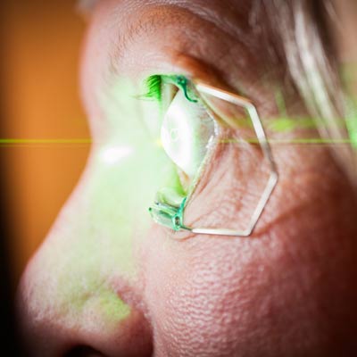 Read more about the article Incorporating DSLT: a new routine in glaucoma treatment