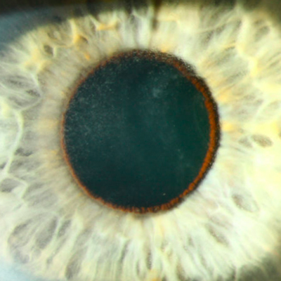 Read more about the article Emerging cancer therapies and potential ocular impact
