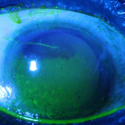 Read more about the article Sjögren’s: anything but routine