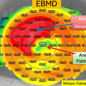 Read more about the article Surface optimization—what’s reasonable?