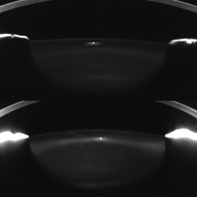 Read more about the article Dysfunctional lens syndrome: opening doors to earlier and customized interventions