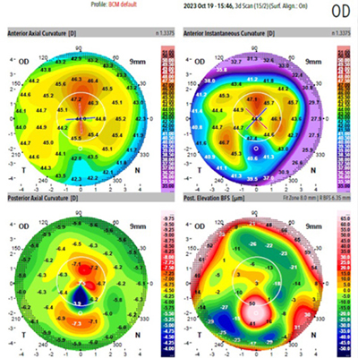 Read more about the article When the Ks don’t align